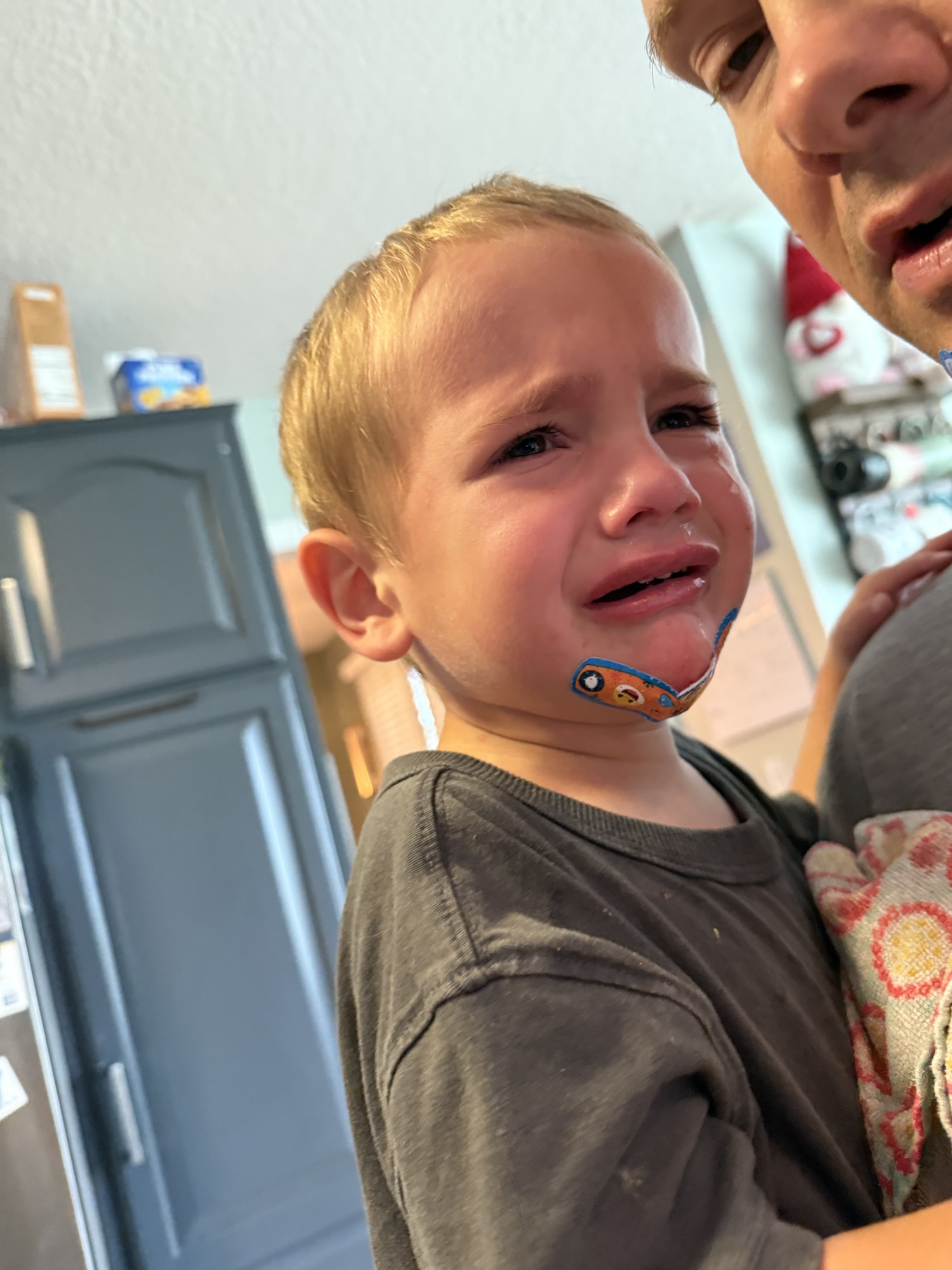 Band of Bandaids: The&nbsp;Chin-cident